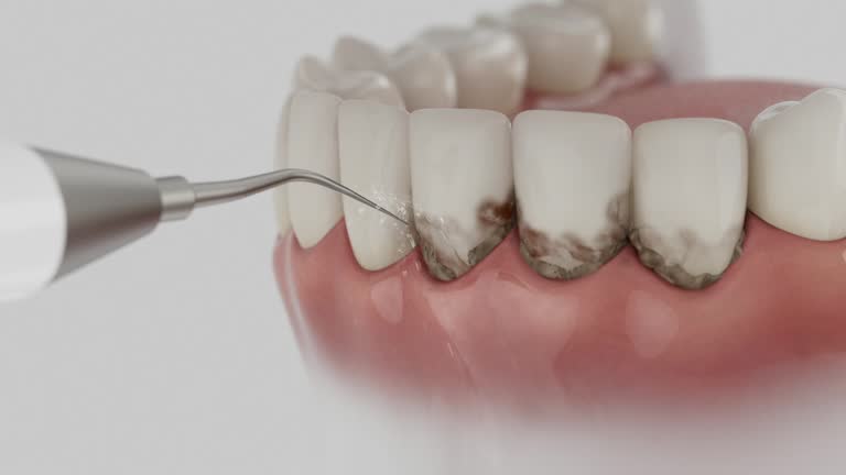 Reliable Dental Implants contractor in Pennside, PA by Smile Center Dentistry